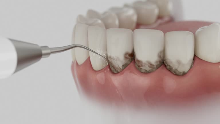 Reliable Dental Implants contractor in Russell, KS by Smile Center Dentistry
